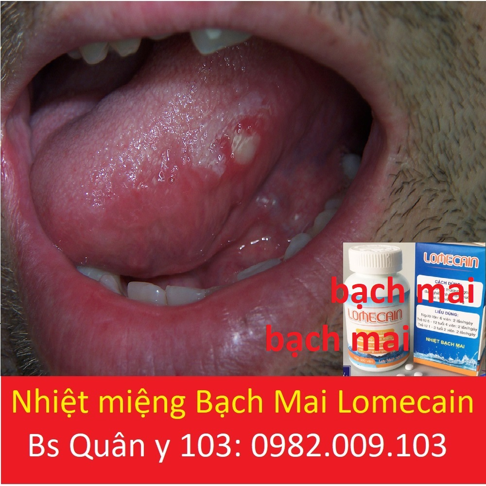 Lọ 500 viên Lomecain nhiệt miệng bạch mai