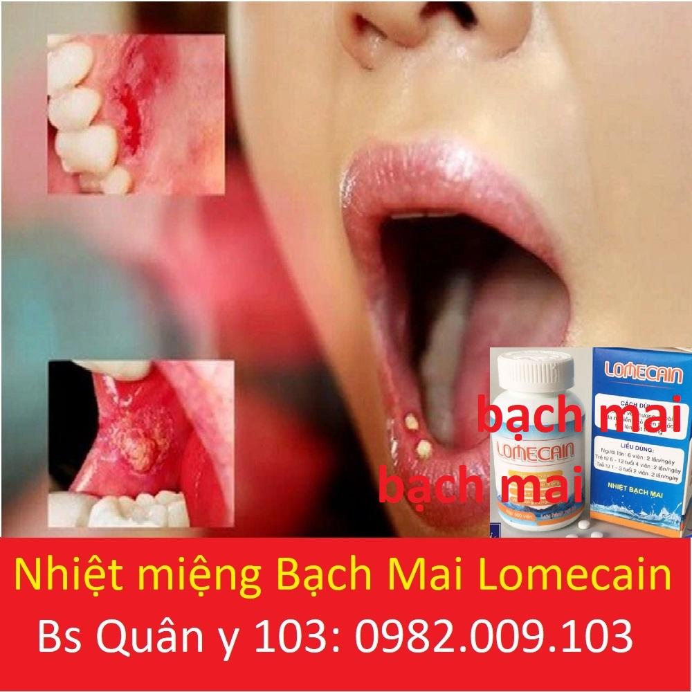 Lọ 500 viên Lomecain nhiệt miệng bạch mai