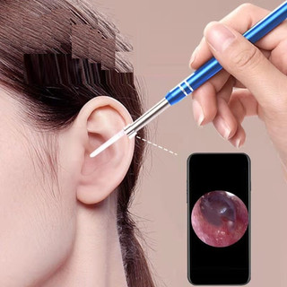 [DÙNG MỌI LOẠI MÁY TÍNH] Máy Nội Soi Tai Thông Minh - Bộ Lấy Ráy Tai Đa Năng Có Camera - Chăm Sóc Sức Khỏe 2 Trong 1