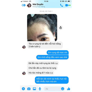 Mọc Tóc Do Thái - Multi Hair date 03/2025