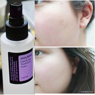 Nước Hoa Hồng Hỗ Trợ Giảm Mụn, Làm Dịu Da, Tẩy Tế Bào Chết Hóa Học Chiết Xuất Rau Má, AHA/BHA Cosrx Alcohol-Free Toner