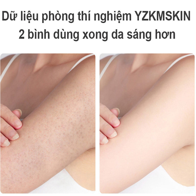 Tẩy tế bào chết gel tẩy tế bào chết tẩy tế bào 250g Làm sạch sâu Làm trắng và dưỡng ẩm 2%Niacinamide
