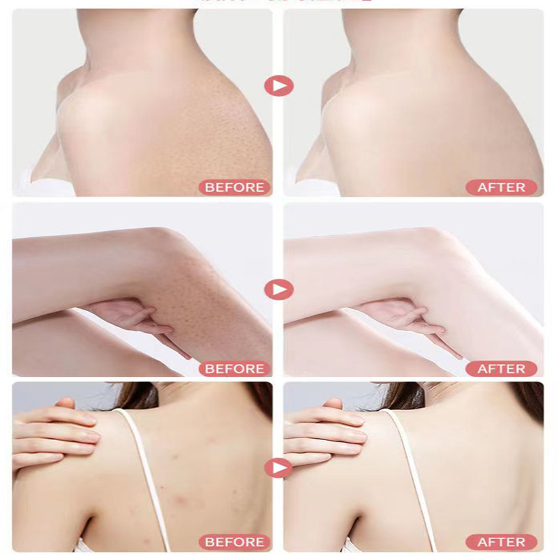 Tẩy tế bào chết gel tẩy tế bào chết tẩy tế bào 250g Làm sạch sâu Làm trắng và dưỡng ẩm 2%Niacinamide