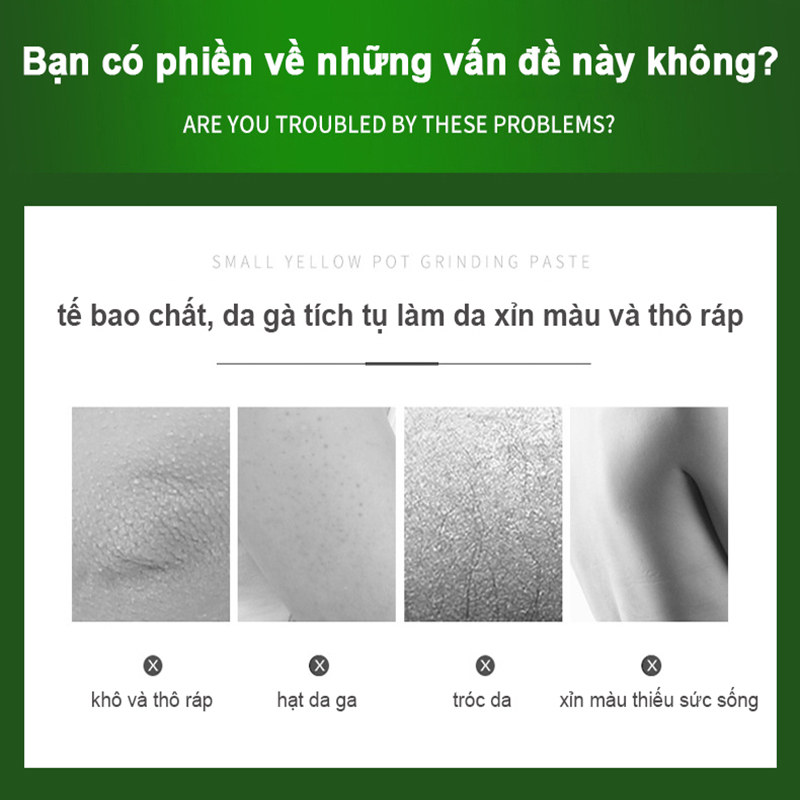 Tẩy tế bào chết gel tẩy tế bào chết tẩy tế bào 250g Làm sạch sâu Làm trắng và dưỡng ẩm 2%Niacinamide