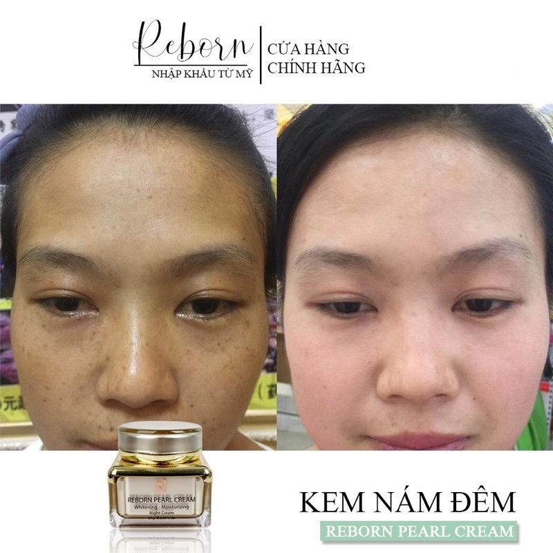 Kem Xoá Nám Tàn Nhang Reborn Và Dưỡng Trắng Da 25Gr Chính Hãng