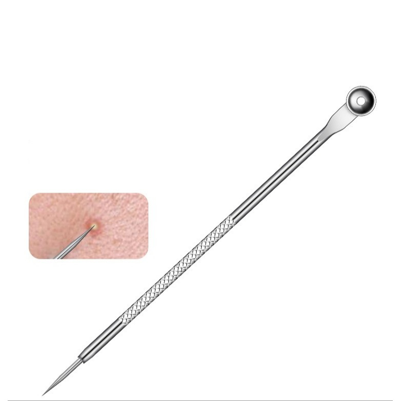 Măng tây baby - Que/Nhíp Gắp Mụn Đầu Đen, Mụn Dưới Da Thông Minh Thép Không Gỉ