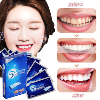 Miếng dán làm trắng răng 3D-5D tiện dụng
