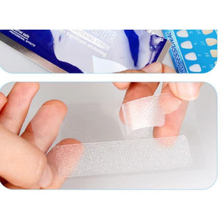 Miếng dán làm trắng răng 3D-5D tiện dụng