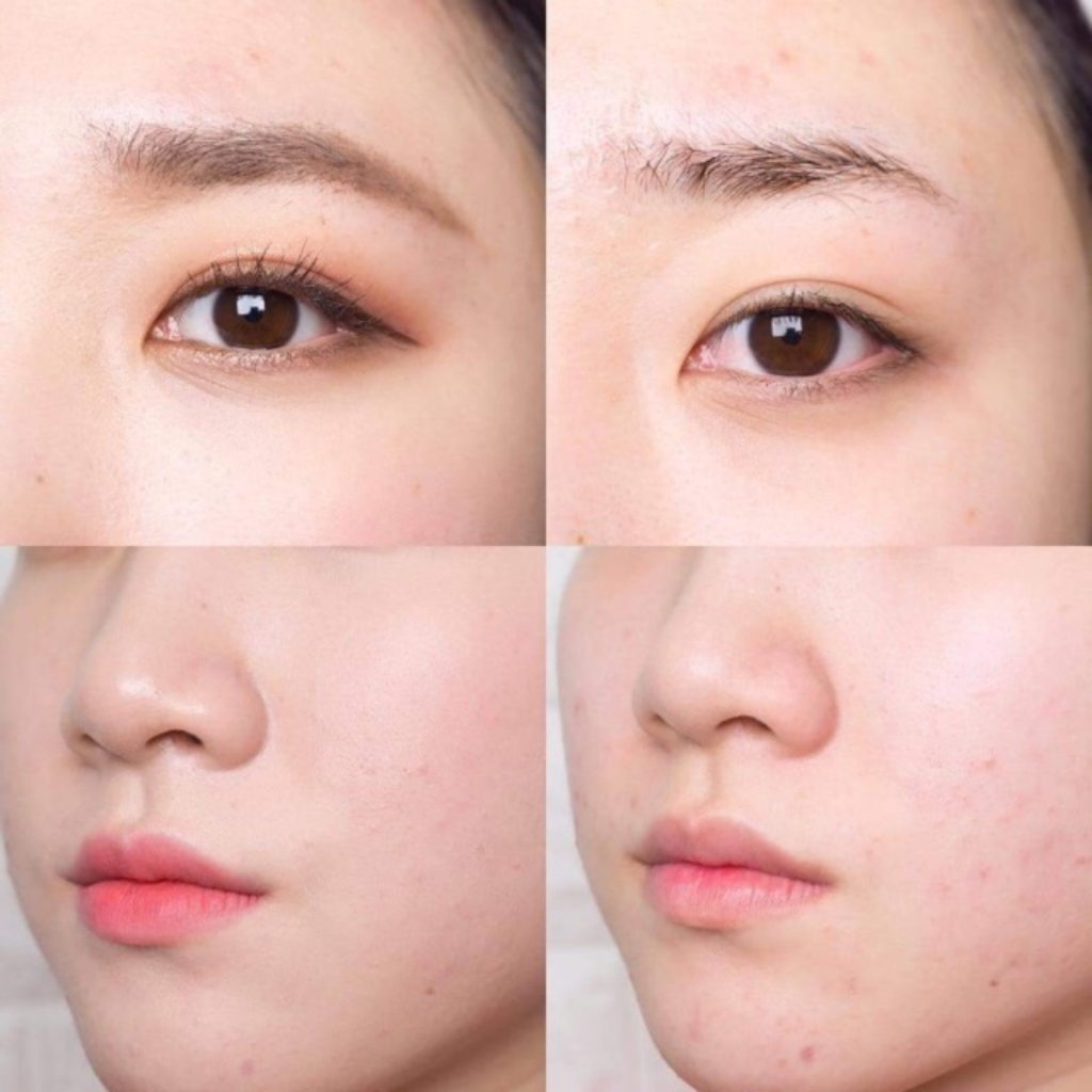 Sáp Tẩy Trang Clinique Take The Day Off Cleansing Balm dung tích 15ml