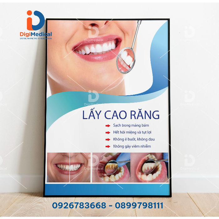 (Tranh Khung) Tranh Nha Khoa - Lấy Cao Răng