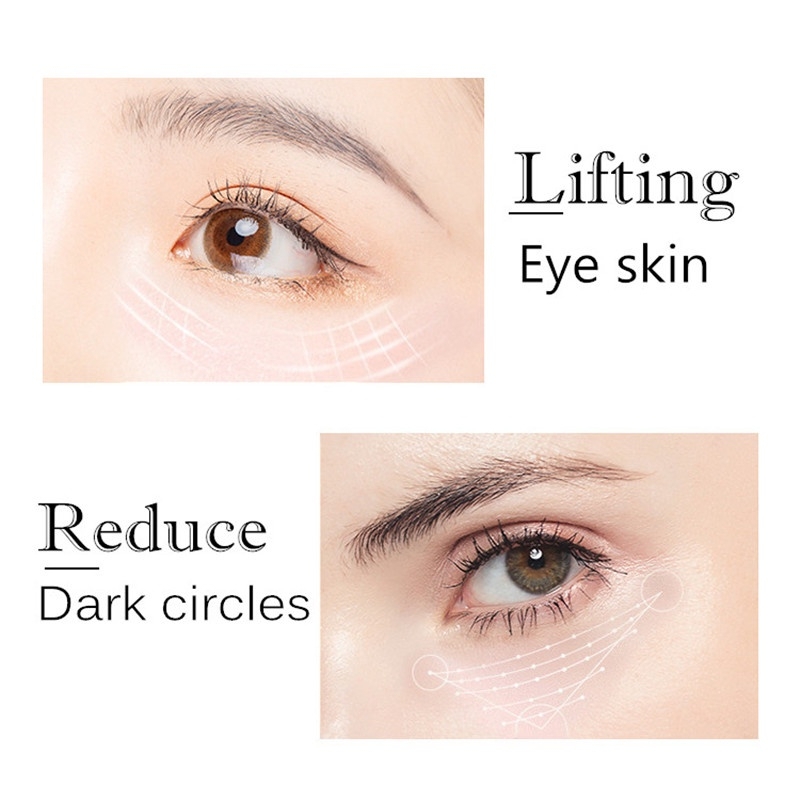 Kem dưỡng mắt , giảm nhăn thâm và bọng mắt - Activating Close Eye Cream