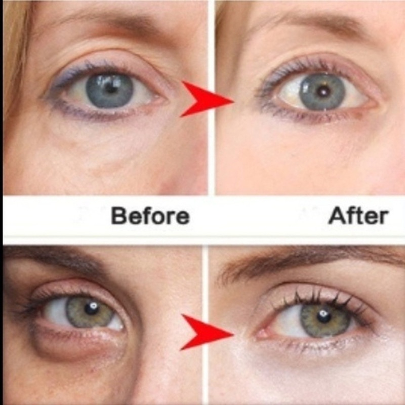 Kem dưỡng mắt , giảm nhăn thâm và bọng mắt - Activating Close Eye Cream