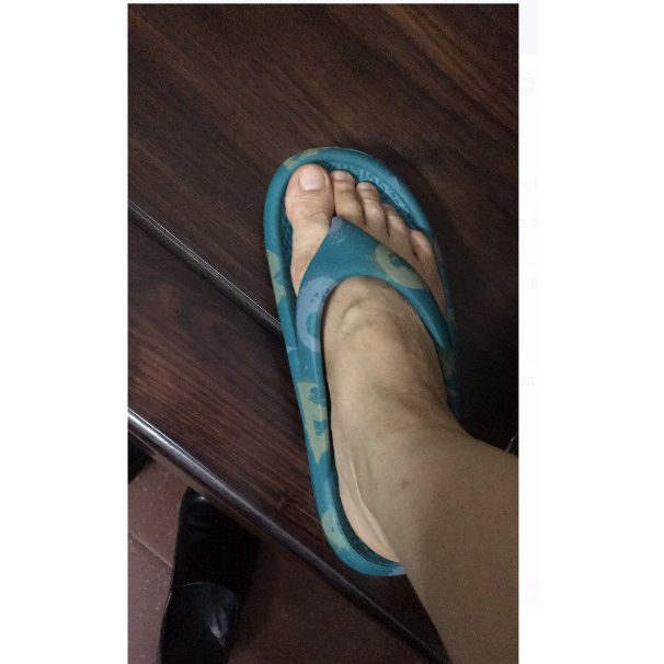 Dép Tông Xỏ Ngón Cao Su Siêu Nhẹ Big Size Dành Cho Người Chân To