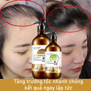Dầu gội kích thích mọc tóc Dầu gội rụng tóc dầu gội gừng 800ml Ngăn rụng tóc Kiểm soát dầu và gàu chăm