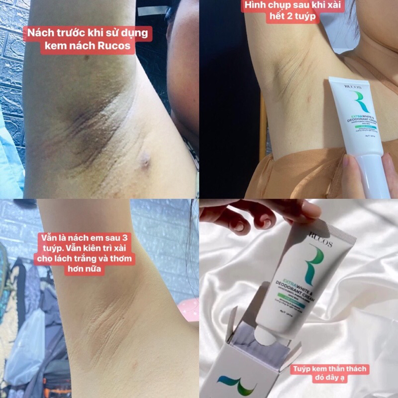 KEM DƯỠNG TRẮNG VÀ NGĂN MÙI CHO NÁCH-𝐄𝐱𝐭𝐫𝐚 𝐖𝐡𝐢𝐭𝐞 & 𝐃𝐞𝐨𝐝𝐨𝐫𝐚𝐧𝐭 𝐂𝐫𝐞𝐚𝐦