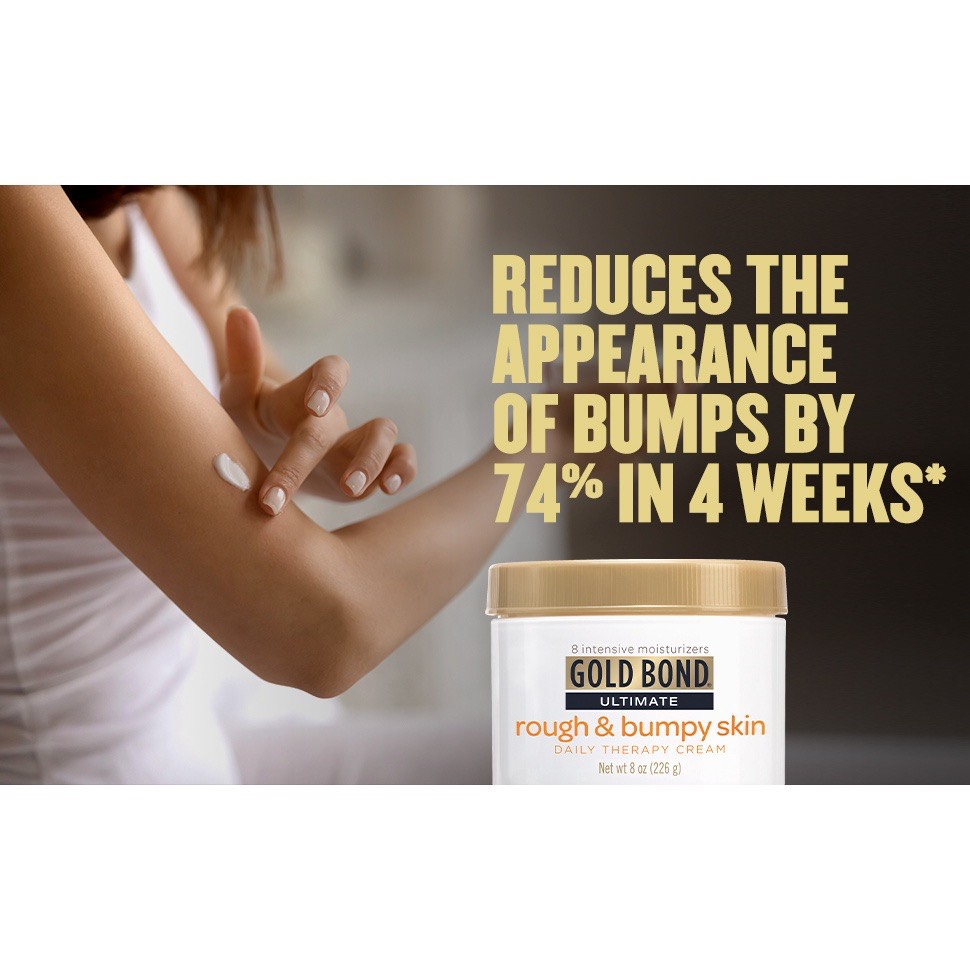 Kem dưỡng da body Gold Bond Ultimate Rough & Bumpy Skin Cream 226G (BILL USA)
