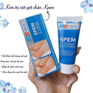 Kem giảm nứt nẻ gót chân apteka của nga 50ml