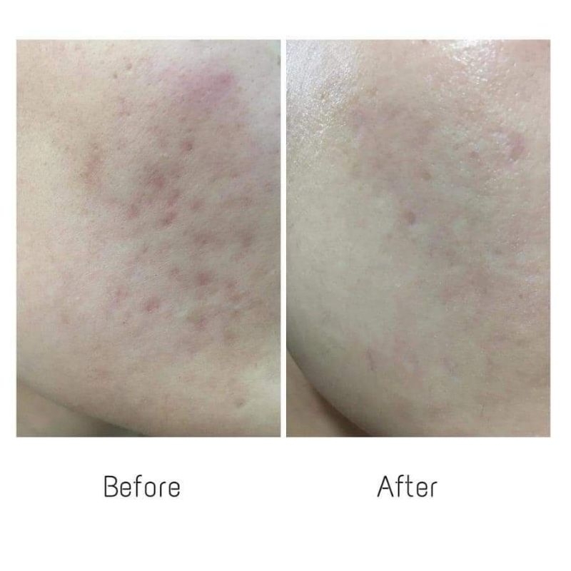 Serum Niacinamide 20% Paula's Choice 2ml