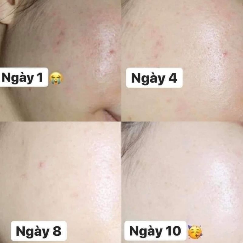 Serum Niacinamide 20% Paula's Choice 2ml