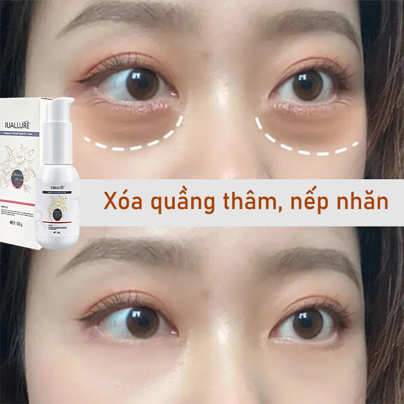 Kem nhăn mắt  kem xoá nhăn mắt  40g tinh chất chống lão loại bỏ các hạt mỡ loại bỏ quầng thâm