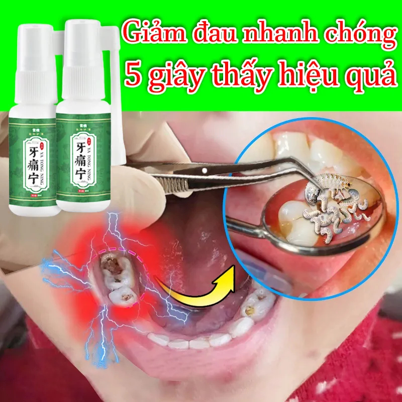 Xịt chống sâu răng Chai Xịt Giảm Đau Răng, Ê Buốt, Giảm Đau Nhức Nhanh Chóng, Ngăn Ngừa Sâu Răng Và Làm Thơm Miệng