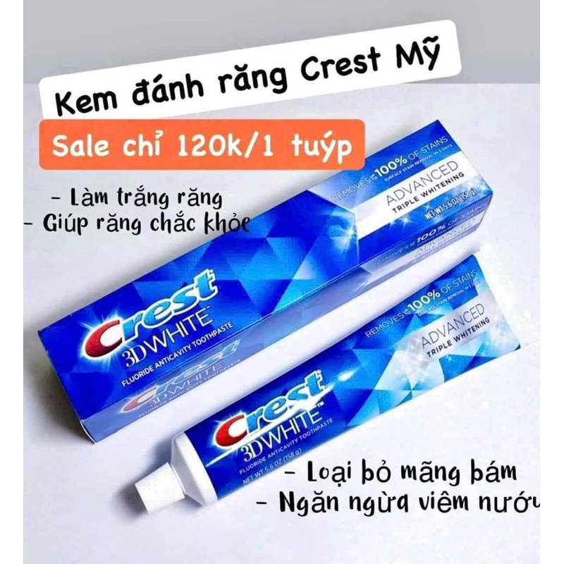 Kem đánh răng crest 3D white 158g