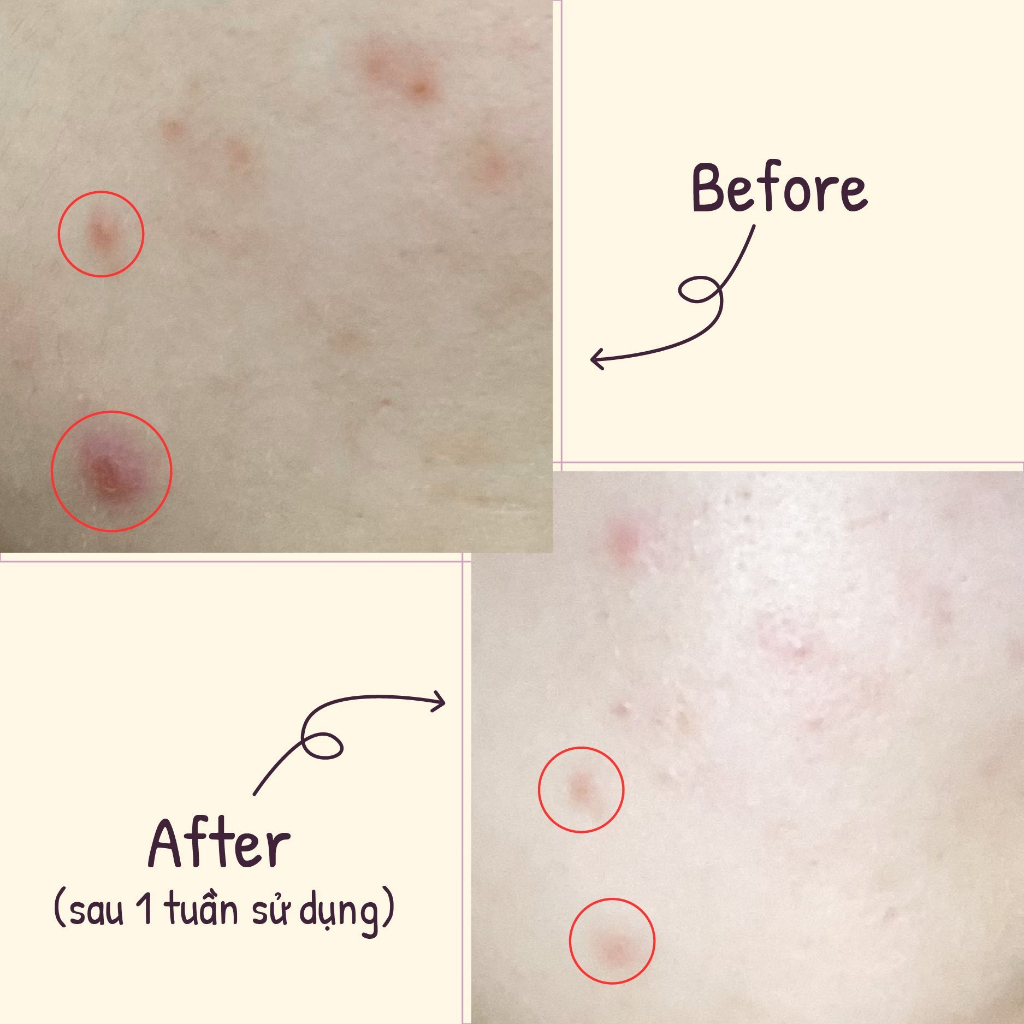 Tinh chất dưỡng sáng kiềm dầu 10% Niacinamide Geek&Gorgeous B-Bomb 30ml