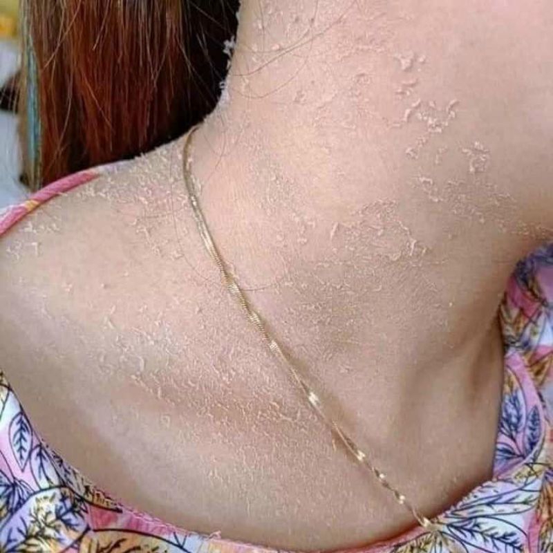 Kem Bong Da Tái Tạo Dành Riêng Cho BODY Mới .