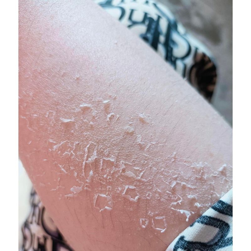 Kem Bong Da Tái Tạo Dành Riêng Cho BODY Mới .