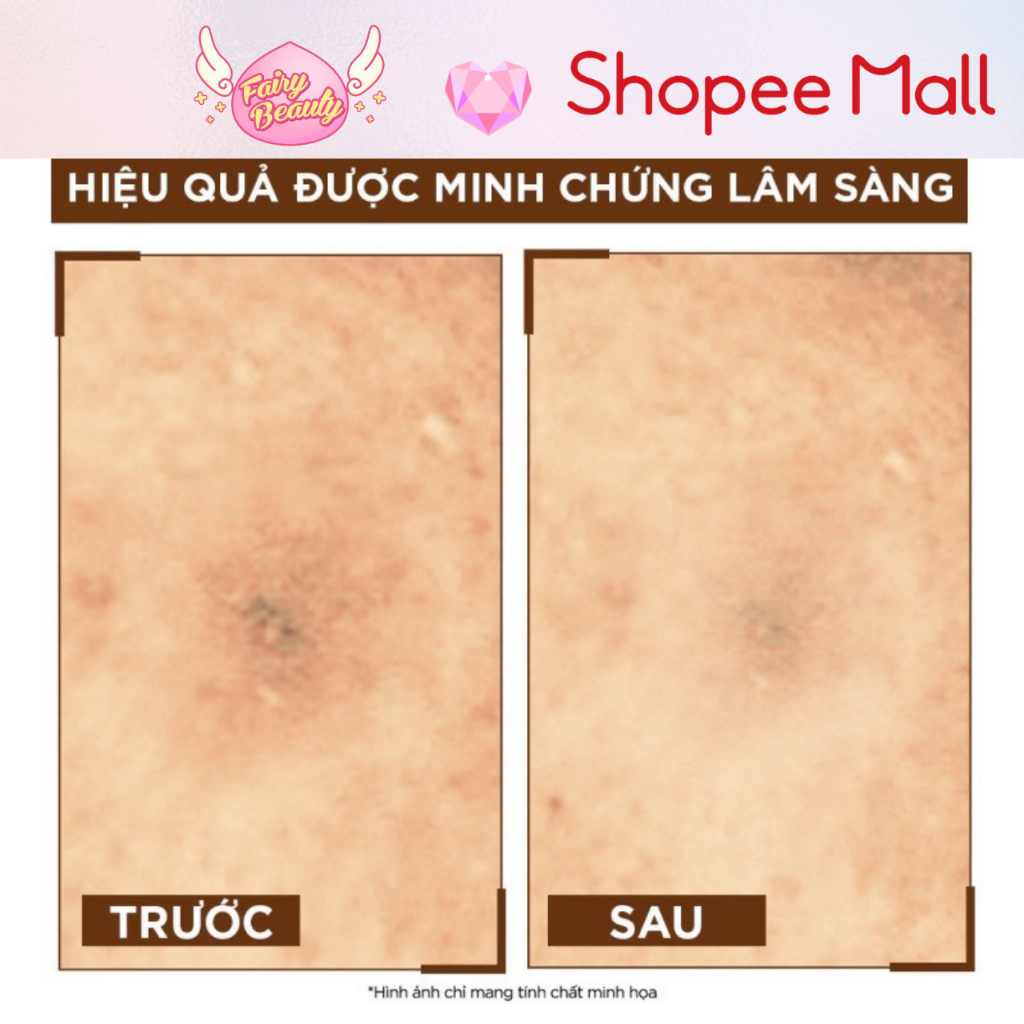 Tinh Chất Dưỡng Ban Đêm 10% Vitamin C Giúp Làm Sáng Da Bright Complete Overnight 10% Pure Vitamin C 30ml