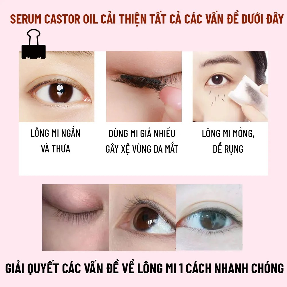 Serum Dưỡng mi CASTOR OIL 10ml, dưỡng mi dày và dài hơn gấp 5 lần, phiên bản tế bào gốc, dài nhanh, cho đôi mắt quyến rũ