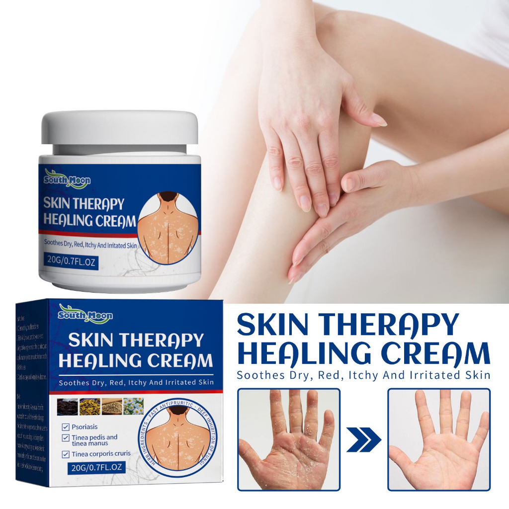 SKIN THERAPY HEALING CREAM - Kem bôi viêm da cơ địa nhập khẩu chính hãng 20g