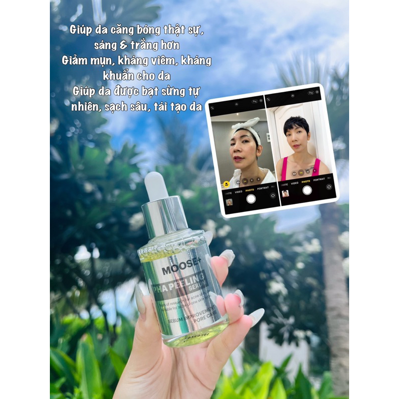 Combo peel da moose + 30ml và serum dưỡng da beta glucan bakuchiol HA B5 Kr.Lab 50ml phục hồi sau peel