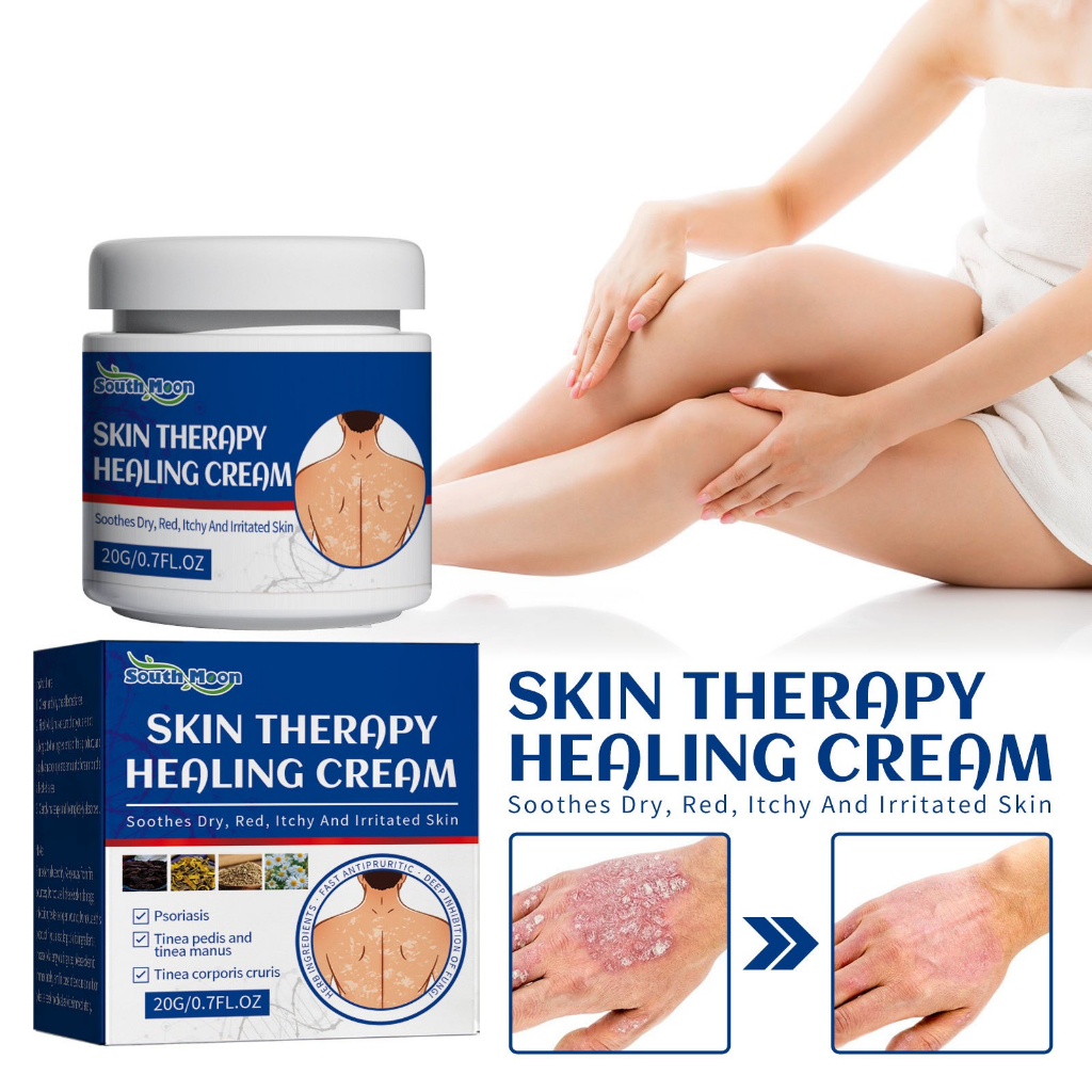 Kem Skin Therapy Healing bôi viêm da cơ địa, chống ngứa, chàm hộp 20g