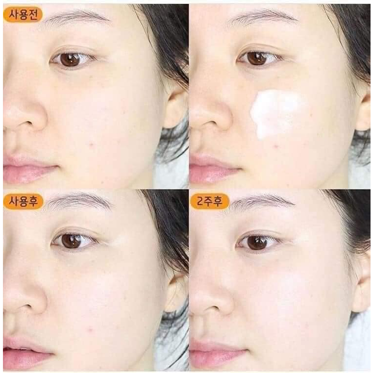 Kem dưỡng trắng mờ thâm nám Laneige Radian-C Cream 10ml