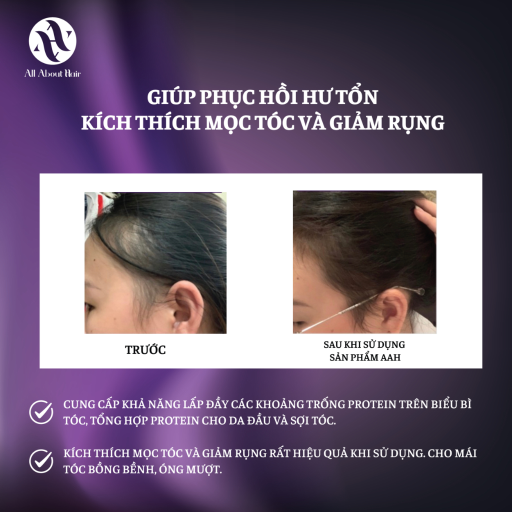 Combo 5 Sản Phẩm Chăm Sóc Tóc AAH All About Hair - Full Set 5 Products