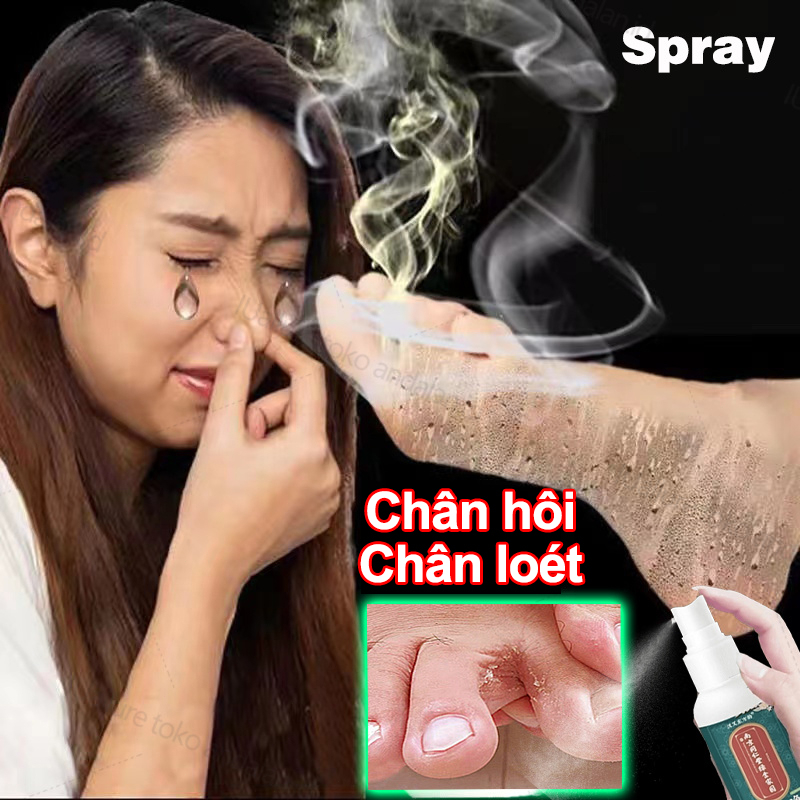 Xịt hôi chân Xịt giảm ngứa khử mùi hôi chân loại bỏ ngứa nấm chân Mồ hôi chân thối chân mụn nước kháng khuẩn 35ml