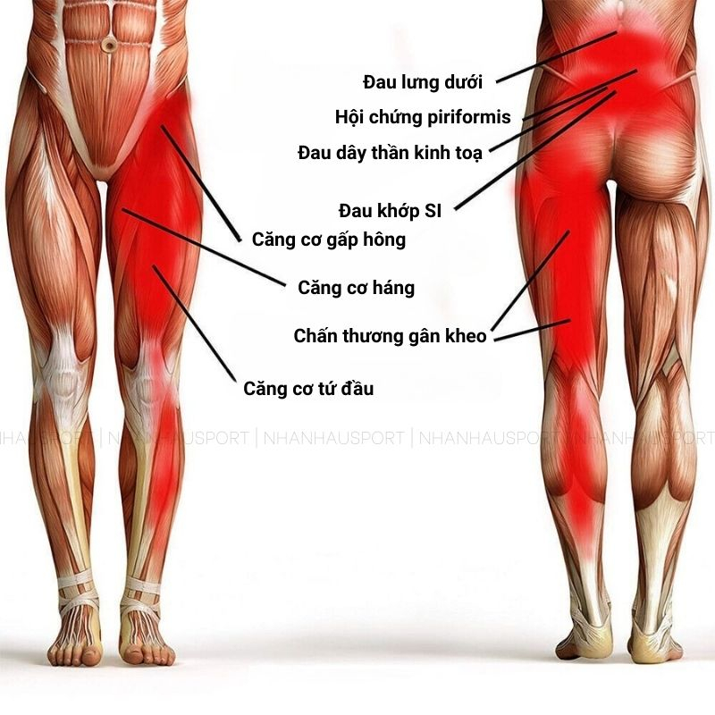 Đai Quấn Bảo Vệ Đùi, Bảo Vệ Xương Chậu, Bảo Vệ Khớp Háng Thoáng Khí Tránh Chấn Thương - Đệm Bảo Vệ Đùi