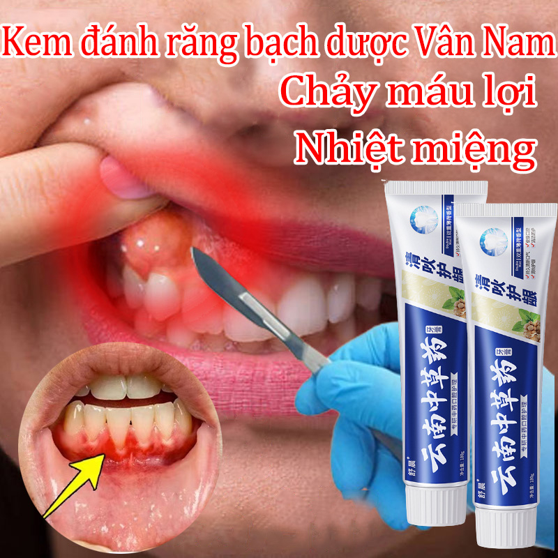 Kem đánh răng thuốc đông y, đánh răng có hiệu quả diệt khuẩn giảm đauchuyên về đau răng viêm chân răng,  nhiệt loé