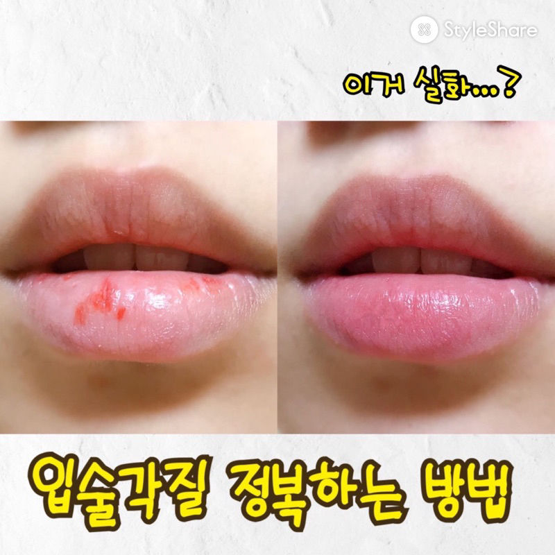 Mặt nạ môi SOS Lip Patch
