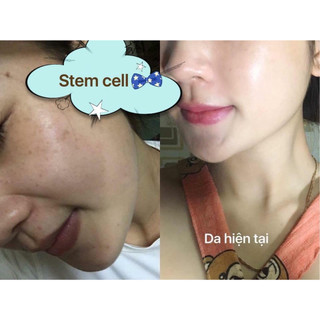 STEM CELL TRẮNG