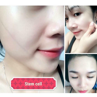 STEM CELL TRẮNG