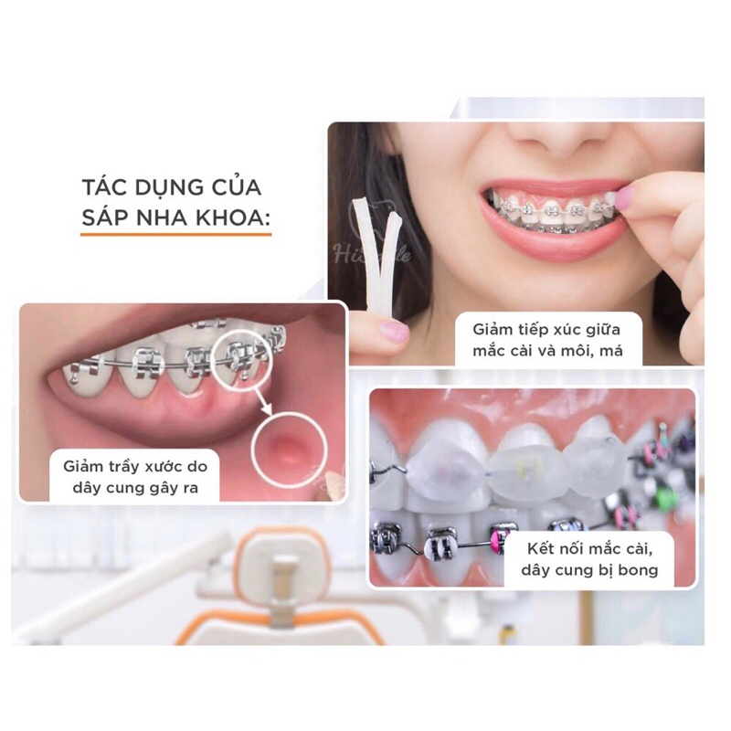 Sáp Nha khoa mua 3 tặng 1