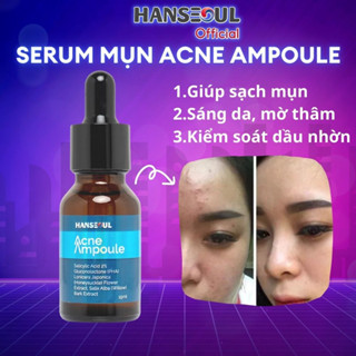Serum giảm mụn thâm, mụn rỗ ACNE AMPOULE phù hợp từ tuổi dậy thì trở lên 15ml chính hãng Hanseoul