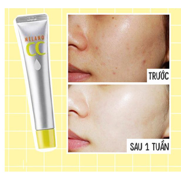 Serum dưỡng trắng da chống thâm nám Melano CC Whitening Essence dạng tuýt 20ml - Nhật Bản