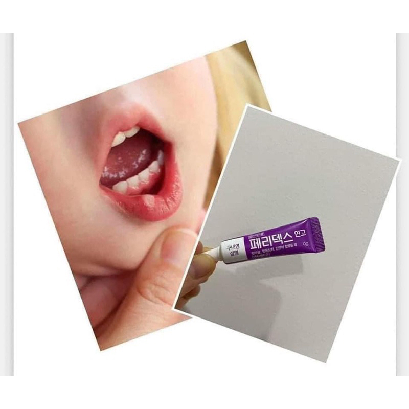 GEL NHIỆT MIỆNG PERIDEX HÀN QUỐC  CHO BÉ 3 TUỔI TRỞ LÊN VÀ NGƯỜI LỚN