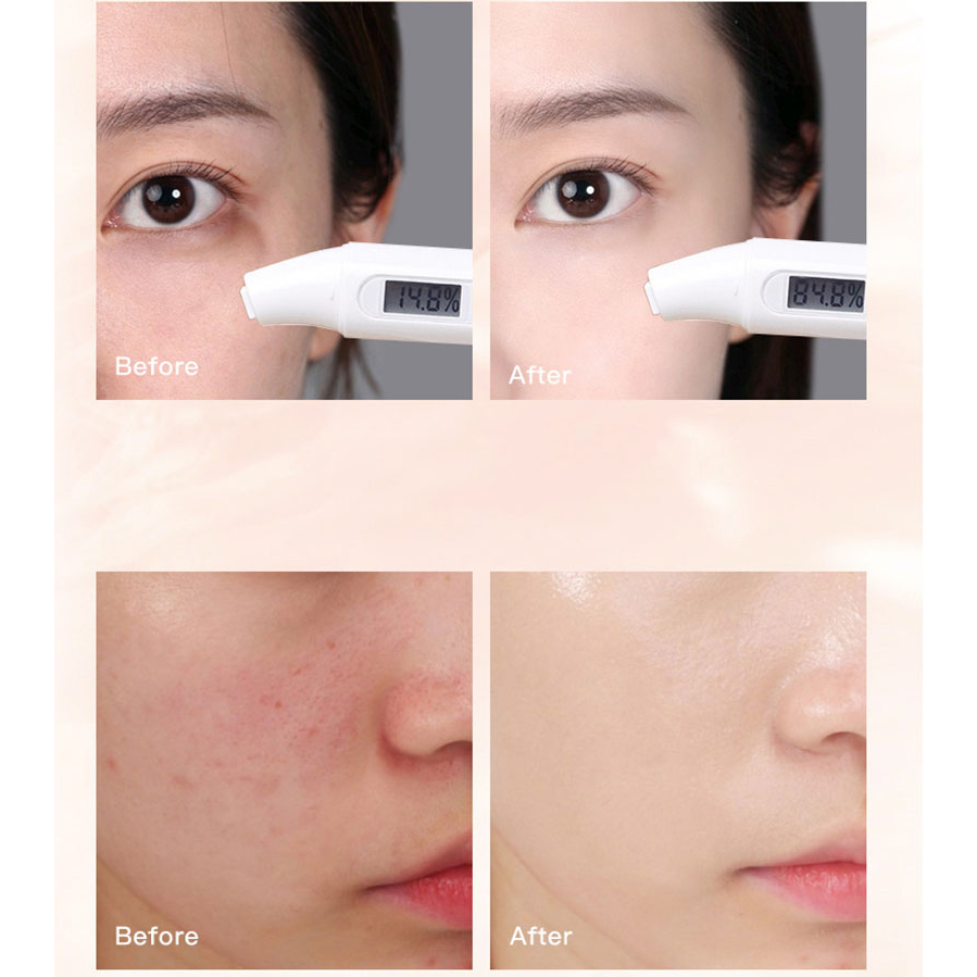 Kem dưỡng trắng da mặt TVLV dưỡng da chuyên sâu cho da mịn màng, Kem trắng da mặt dưỡng ẩm làm sáng mềm mịn da