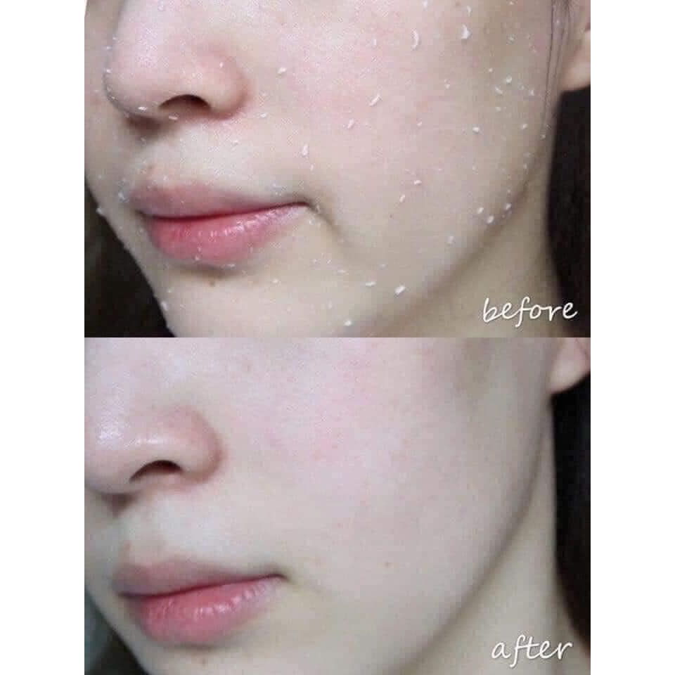 Tẩy da chết ngọc trai The Faceshop