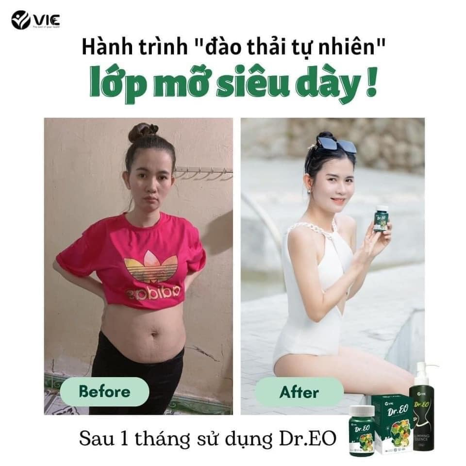 Giảm mỡ bụng - VIEN SƠ DR.EO - Viên thải mỡ detox sâm đỏ chính hãng