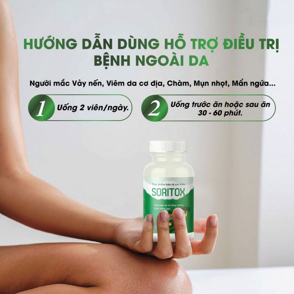 Soritox 45 Viên Cho Người Vảy nến, Viên da cơ địa, Mẩn Ngứa, Nóng Trong